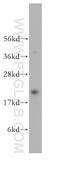 RAB9A, Member RAS Oncogene Family antibody, 11420-1-AP, Proteintech Group, Western Blot image 