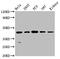 N-Myc Downstream Regulated 1 antibody, CSB-RA835678A0HU, Cusabio, Western Blot image 