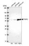 Thymopoietin antibody, HPA008150, Atlas Antibodies, Western Blot image 