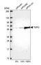 TMPO antibody, HPA008150, Atlas Antibodies, Western Blot image 