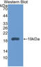 Interleukin 1 Receptor Antagonist antibody, LS-C314166, Lifespan Biosciences, Western Blot image 