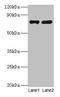 Poly(A)-Specific Ribonuclease antibody, LS-B12265, Lifespan Biosciences, Western Blot image 