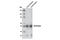 Cytochrome P450 Family 19 Subfamily A Member 1 antibody, 8799S, Cell Signaling Technology, Western Blot image 