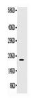 KIT Ligand antibody, RP1010, Boster Biological Technology, Western Blot image 