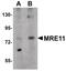 MRE11 Homolog, Double Strand Break Repair Nuclease antibody, PA5-20870, Invitrogen Antibodies, Western Blot image 