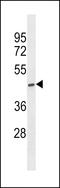 ST6 N-Acetylgalactosaminide Alpha-2,6-Sialyltransferase 5 antibody, LS-C156155, Lifespan Biosciences, Western Blot image 