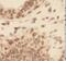 CUGBP Elav-Like Family Member 1 antibody, FNab02071, FineTest, Immunohistochemistry paraffin image 