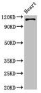 Integrin Subunit Alpha 5 antibody, LS-C672805, Lifespan Biosciences, Western Blot image 