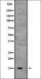 NADH:Ubiquinone Oxidoreductase Subunit B6 antibody, orb335048, Biorbyt, Western Blot image 