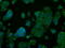 AKT Serine/Threonine Kinase 2 antibody, GTX84908, GeneTex, Immunocytochemistry image 