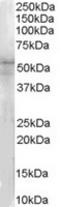 Interleukin 1 Receptor Associated Kinase 4 antibody, TA302664, Origene, Western Blot image 