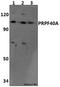 Pre-MRNA Processing Factor 40 Homolog A antibody, GTX66802, GeneTex, Western Blot image 