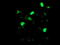 lim1 antibody, M05816, Boster Biological Technology, Immunofluorescence image 