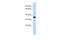 Cilia And Flagella Associated Protein 298 antibody, 26-085, ProSci, Enzyme Linked Immunosorbent Assay image 