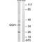 Gamma-Glutamyl Hydrolase antibody, A03161, Boster Biological Technology, Western Blot image 