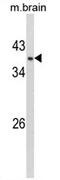 Glycerol-3-phosphate dehydrogenase [NAD+], cytoplasmic antibody, AP17436PU-N, Origene, Western Blot image 