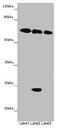 TOX High Mobility Group Box Family Member 3 antibody, CSB-PA024075LA01HU, Cusabio, Western Blot image 