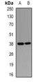 Phytanoyl-CoA 2-Hydroxylase antibody, orb341031, Biorbyt, Western Blot image 