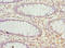 Peripherin antibody, LS-C676313, Lifespan Biosciences, Immunohistochemistry paraffin image 