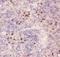 Bruton Tyrosine Kinase antibody, PB9134, Boster Biological Technology, Immunohistochemistry frozen image 