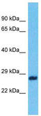 Zinc Finger CCHC-Type Containing 9 antibody, TA342980, Origene, Western Blot image 