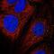 Adaptor Related Protein Complex 1 Subunit Mu 2 antibody, NBP2-55000, Novus Biologicals, Immunofluorescence image 