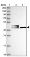 Chitinase Domain Containing 1 antibody, PA5-58761, Invitrogen Antibodies, Western Blot image 