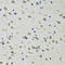 Chloride Intracellular Channel 1 antibody, LS-C335661, Lifespan Biosciences, Immunohistochemistry frozen image 