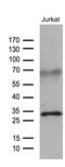 GTP Cyclohydrolase 1 antibody, M01210, Boster Biological Technology, Western Blot image 