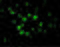 Apoptotic Peptidase Activating Factor 1 antibody, GTX22001, GeneTex, Western Blot image 