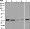 Glutamate-Cysteine Ligase Modifier Subunit antibody, ab126704, Abcam, Western Blot image 