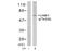 LIM Domain Kinase 2 antibody, AP02415PU-S, Origene, Western Blot image 