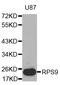 60S ribosomal protein L9 antibody, abx127037, Abbexa, Western Blot image 