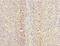 Cell Division Cycle 7 antibody, LS-C682093, Lifespan Biosciences, Immunohistochemistry paraffin image 