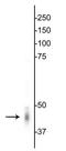 Gamma-Aminobutyric Acid Type A Receptor Gamma2 Subunit antibody, GTX31013, GeneTex, Western Blot image 