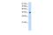 Poly(A) Binding Protein Interacting Protein 1 antibody, GTX47344, GeneTex, Western Blot image 