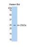 Vav Guanine Nucleotide Exchange Factor 3 antibody, LS-C299876, Lifespan Biosciences, Western Blot image 