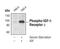 Insulin Like Growth Factor 1 Receptor antibody, MA5-15148, Invitrogen Antibodies, Western Blot image 