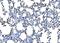 C-Type Lectin Domain Containing 7A antibody, A02731-1, Boster Biological Technology, Immunohistochemistry paraffin image 