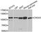 Cyclic Nucleotide Gated Channel Alpha 3 antibody, A3288, ABclonal Technology, Western Blot image 