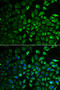 Inositol monophosphatase 1 antibody, 22-174, ProSci, Immunofluorescence image 