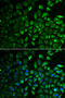 Inositol Monophosphatase 1 antibody, 22-174, ProSci, Immunofluorescence image 