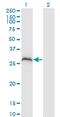 PPP1R2 Family Member B antibody, MA5-23117, Invitrogen Antibodies, Western Blot image 