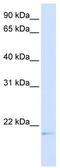 Chromosome 14 Open Reading Frame 180 antibody, TA336148, Origene, Western Blot image 