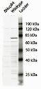 Nucleoporin 88 antibody, EB10654, Everest Biotech, Western Blot image 