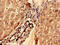 G0/G1 Switch 2 antibody, CSB-PA009114EA01HU, Cusabio, Immunohistochemistry paraffin image 