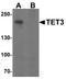 Methylcytosine dioxygenase TET3 antibody, A03371, Boster Biological Technology, Western Blot image 