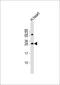 Adenylate Kinase 2 antibody, 63-415, ProSci, Western Blot image 