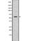 Glucagon-like peptide 1 receptor antibody, abx215626, Abbexa, Western Blot image 