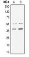 Transcription Factor 7 antibody, LS-C352911, Lifespan Biosciences, Western Blot image 